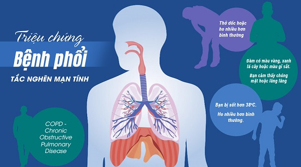 Xử trí cấp cứu – dự phòng đợt cấp bệnh phổi tắc nghẽn mãn tính