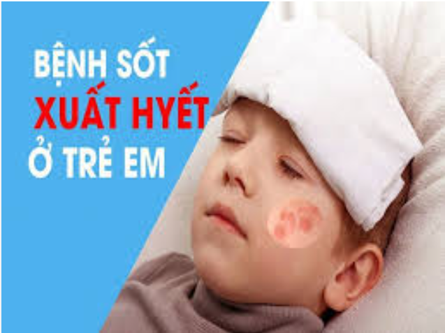 Chẩn đoán điều trị Sốt xuất huyết Dengue ở trẻ em