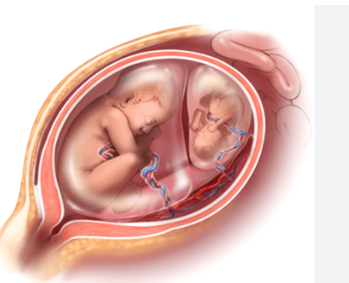 30 GENETIC OBSTETRICAL SYNDROMES, THEIR CAUSES, & THEIR INHERITANCE PATTERNS