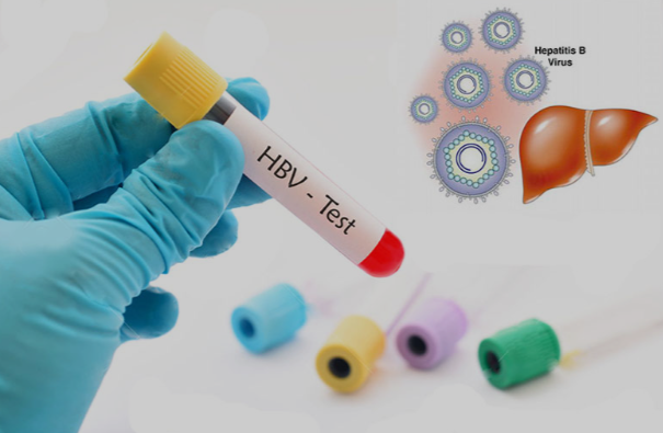 How to interpret the results of HBV tests for diagnosis and its follow-up?