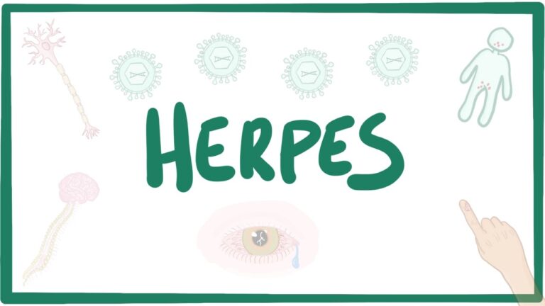 HSV: Signs, Diagnosis, Management & Prognosis, And How Kids can get Herpes