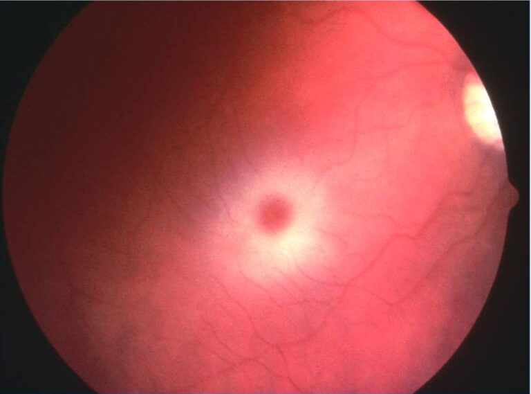 CHERRY OR NOT CHERRY?